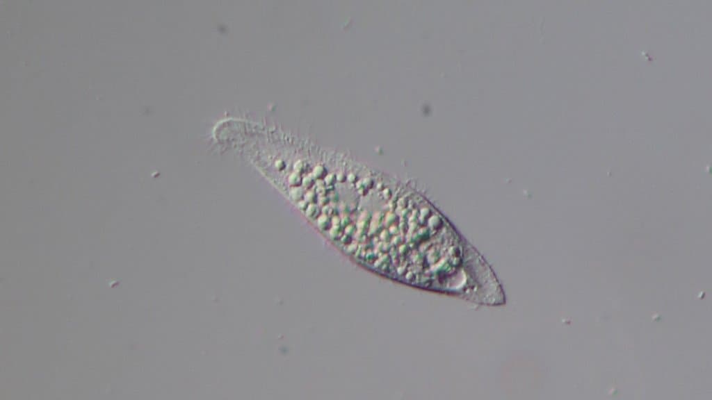 Light-microscope image of a single-celled ciliate protist magnified 160 times