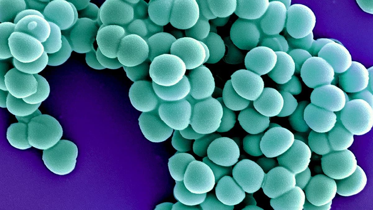 Colorized scanning electron micrograph of clustered spherical MRSA bacteria