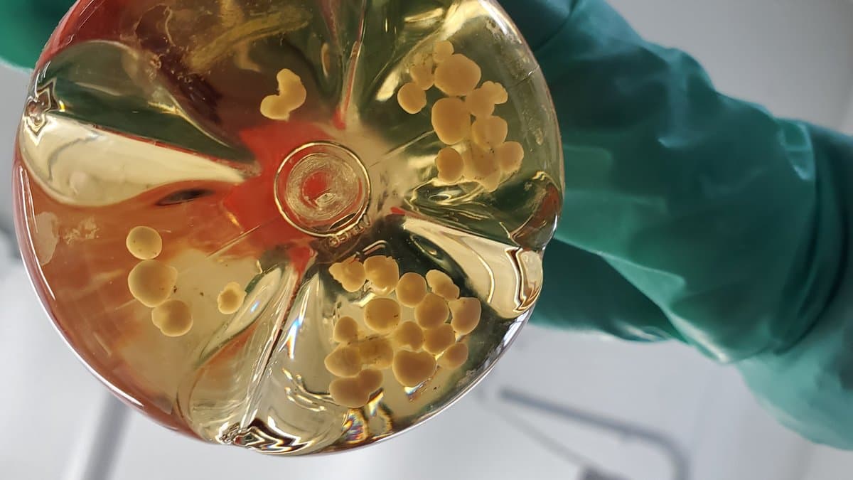 A gloved hand holds a culture flask of pale yellow liquid containing dozens of pale, bead-sized human cerebral organoids