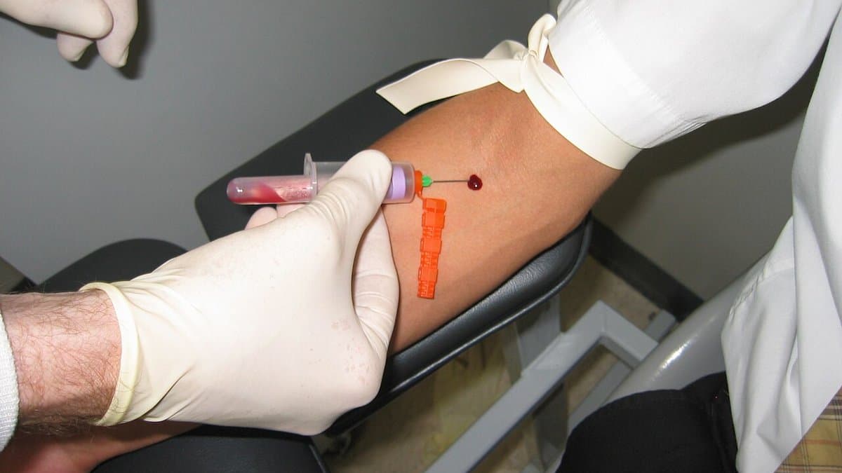 A needle in a vein at the inside of a person's elbow during a blood draw, with a collection tube attached