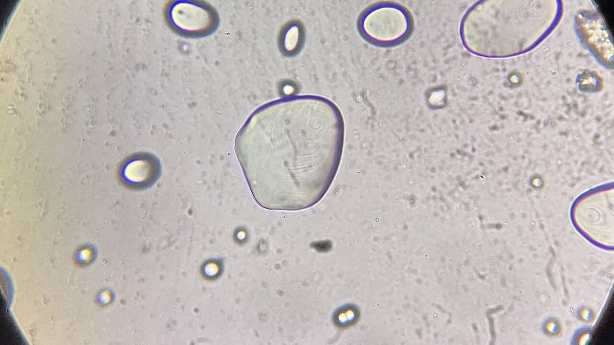 Oval starch granules seen through a microscope, showing their layered internal rings