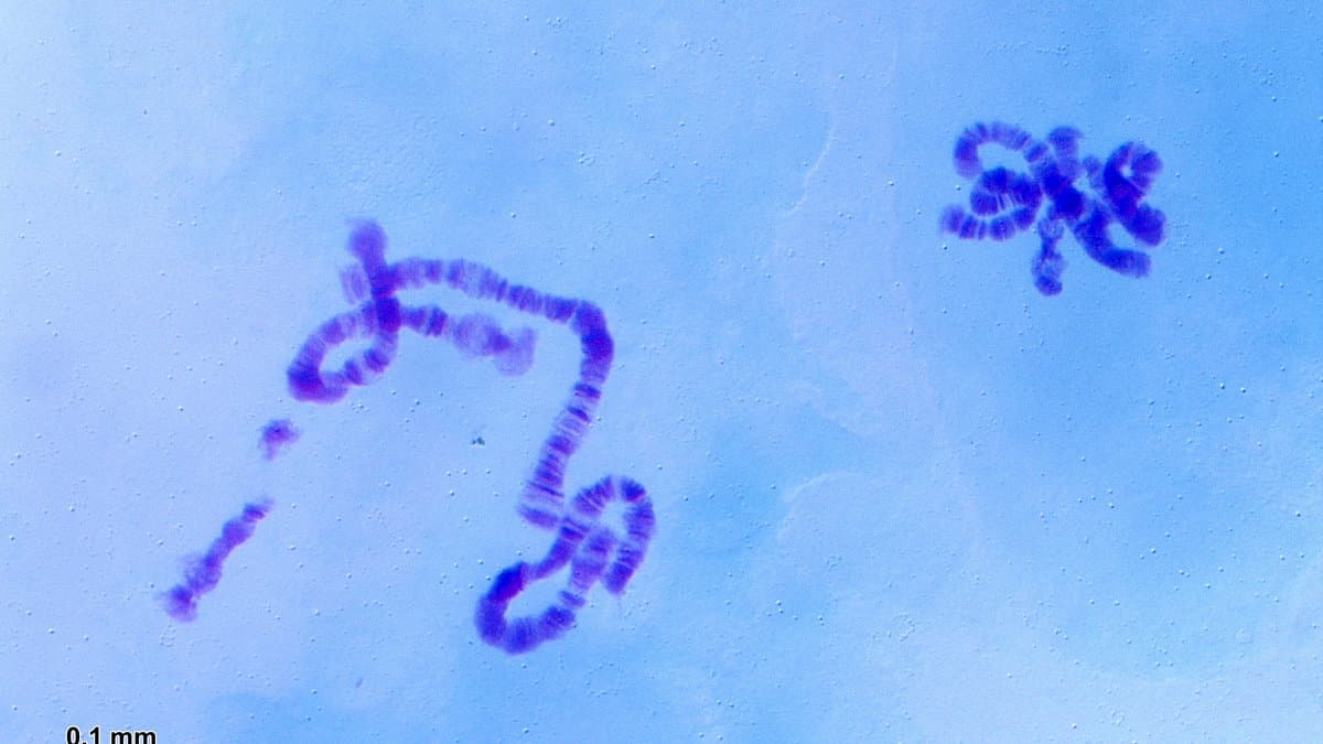 Light micrograph of banded giant polytene chromosomes from the salivary gland of a midge larva