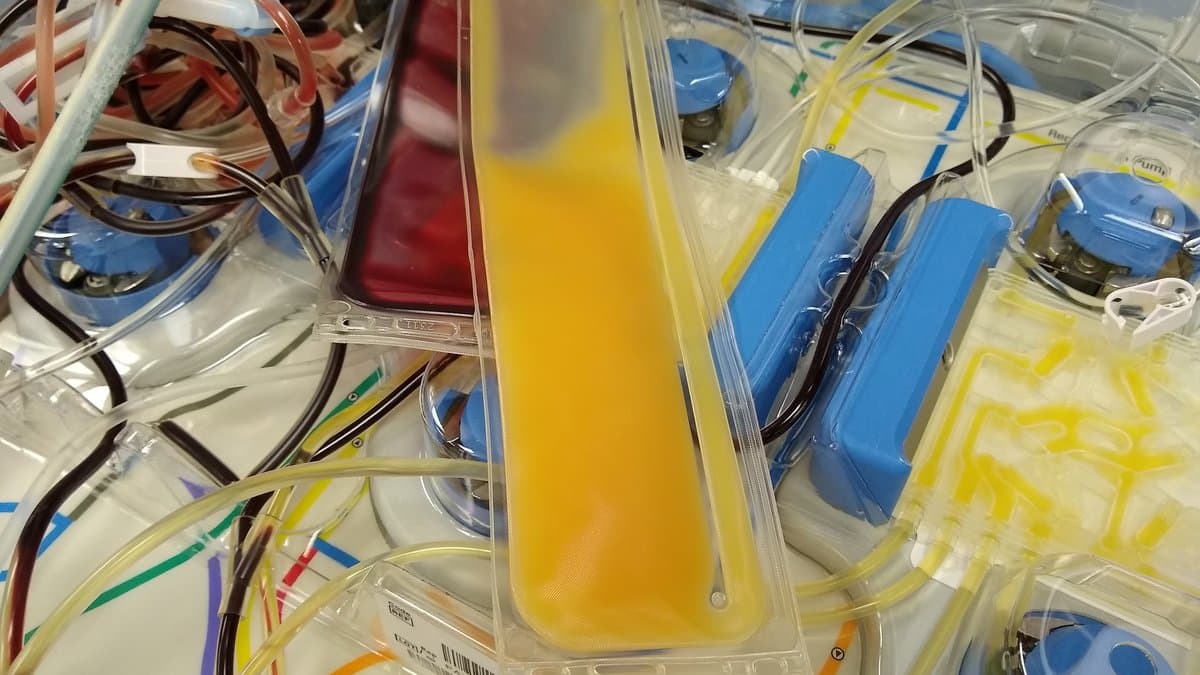 A straw-yellow bag of apheresis-collected platelets lying among other blood-component bags and their tubing in a blood bank