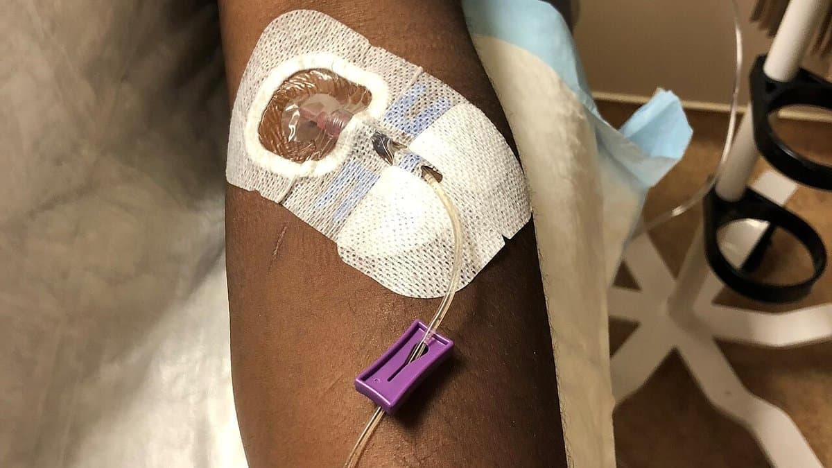 A forearm with a taped intravenous cannula and infusion line delivering a drug to a clinical trial participant
