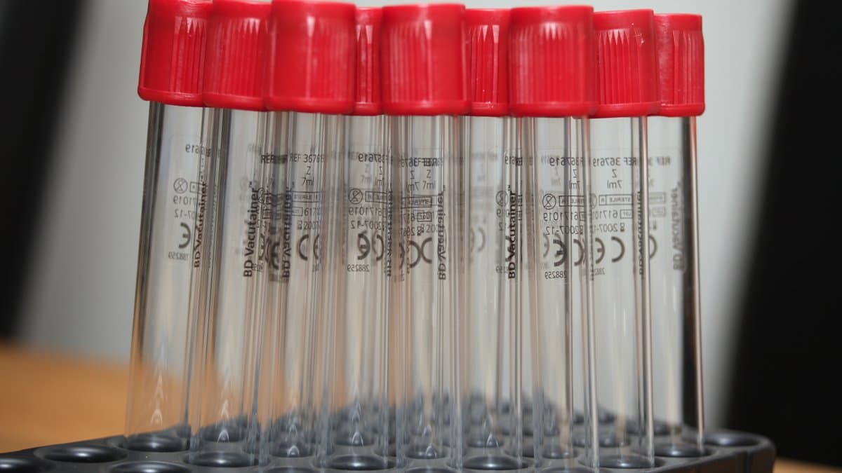 A rack of unused red-capped vacutainer blood collection tubes