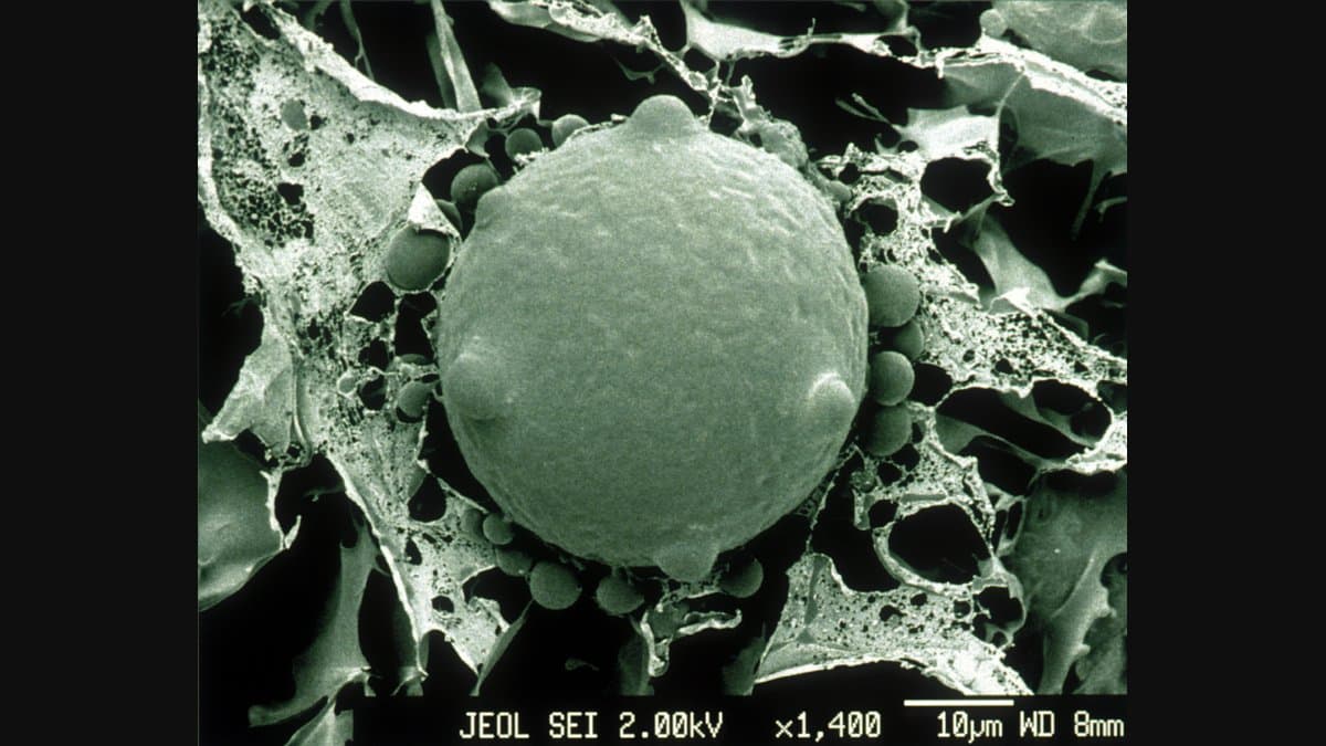 Scanning electron micrograph of chytrid fungus cells, showing rounded sporangia with slender discharge tubes on a textured surface.