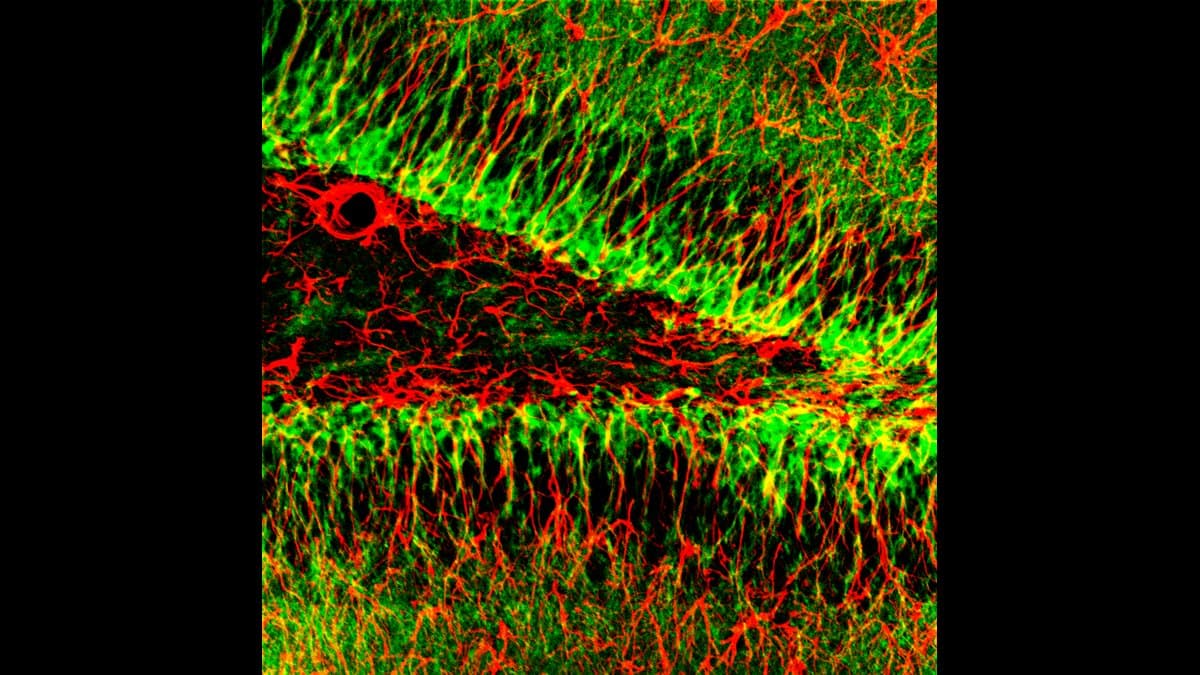 Fluorescence micrograph of the dentate gyrus with doublecortin-labelled immature neurons glowing along the granule cell layer.