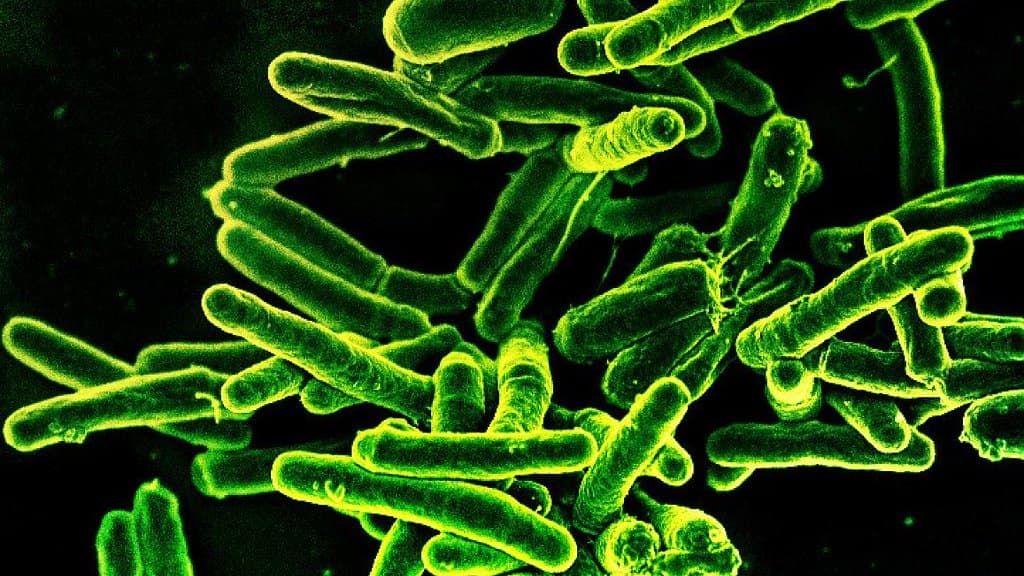 Colourised scanning electron micrograph showing a cluster of rod-shaped Mycobacterium tuberculosis bacteria in bright green against a black background.
