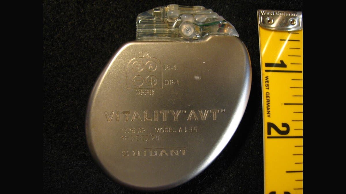 An implantable cardioverter-defibrillator, a smooth metal disc with a clear plastic lead connector block, photographed next to a ruler showing it is about two inches across.