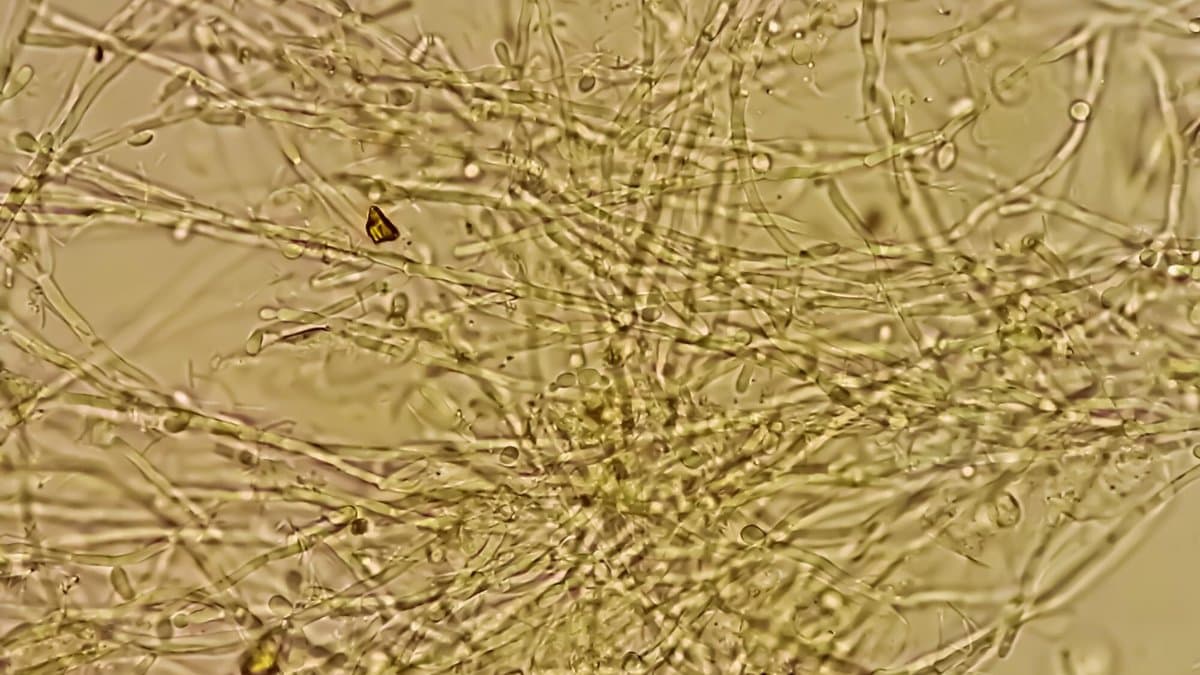 Light-microscope field showing a dense tangle of fungal pseudohyphae with attached budding yeast cells.