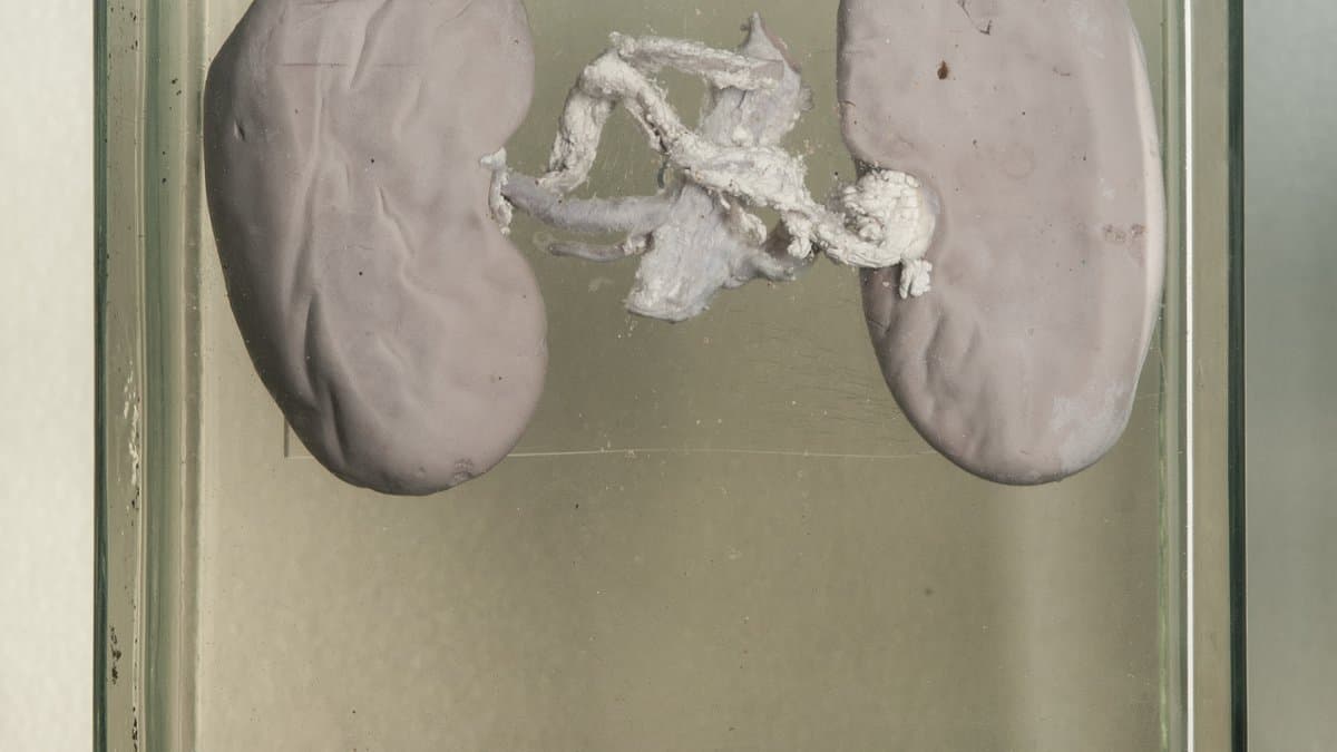 Two preserved kidneys of a domestic pig suspended in a glass jar of fixative, joined at the centre by pale vessels and ureters