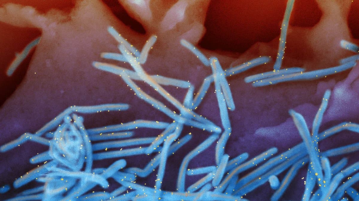 Colorized scanning electron micrograph showing blue rod-shaped respiratory syncytial virus particles, flecked with gold antibody labels, shedding from the orange and purple surface of a human lung cell.