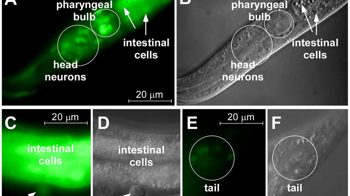 Fluorescence and differential-interference-contrast microscopy of the transparent nematode C. elegans showing gene-expression patterns along its body