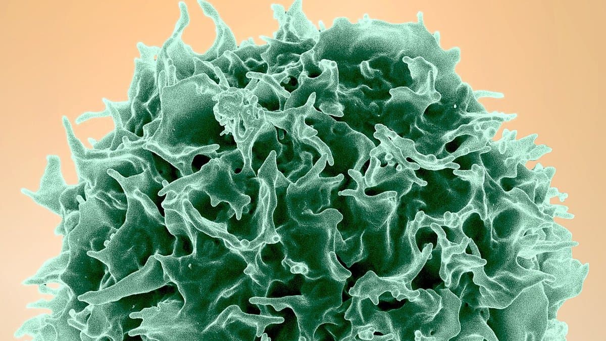 A colourised scanning electron micrograph of a single human T cell: a roughly spherical cell rendered in green, its whole surface thrown into deep folds and thin spiky projections, against a plain peach-coloured background.