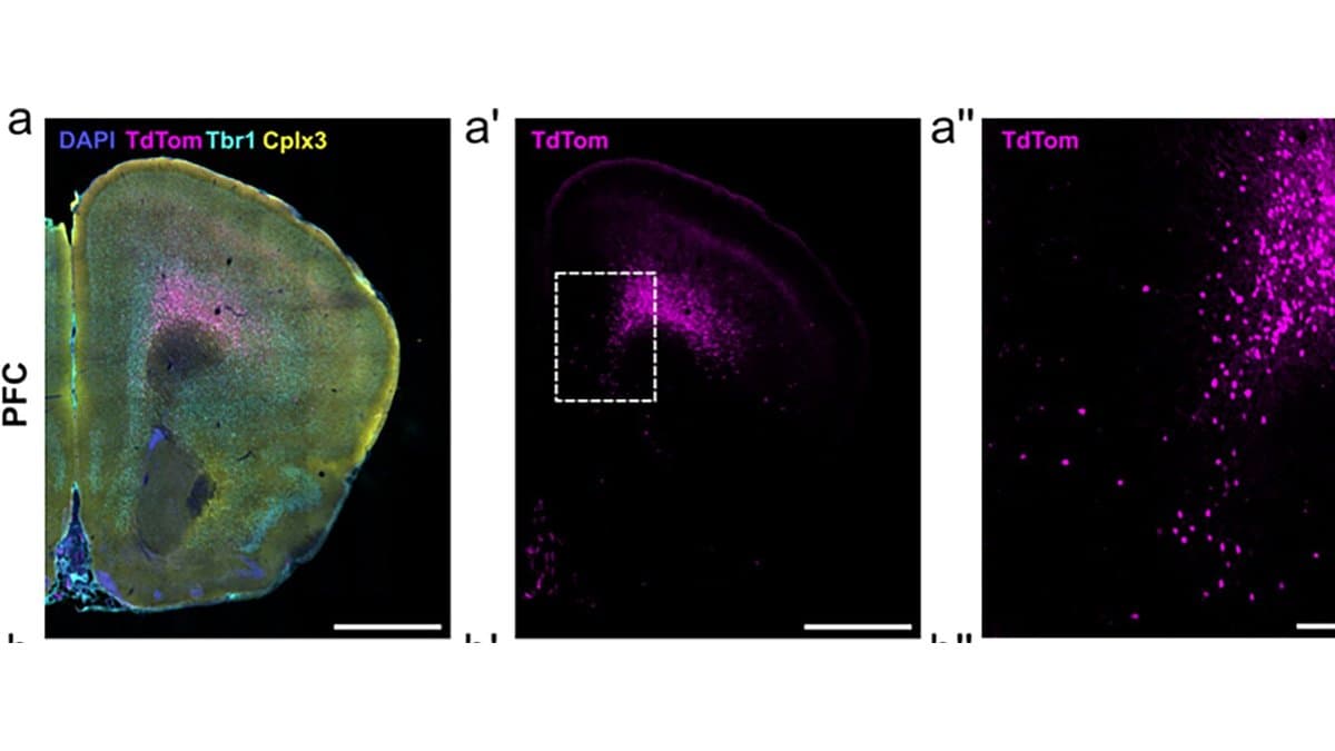 Three-panel fluorescence micrograph of a mouse prefrontal cortex hemisection: magenta-labelled cells form a dense band deep in the cortex at layer 6b, with a magnified close-up at right.