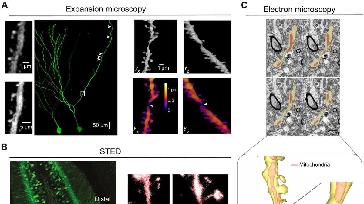 Scientific figure combining fluorescence microscopy of mouse neurons in green on a black background, grayscale close-ups of dendrites with arrowheads marking narrow pinches, and electron-microscope sections with one dendrite shaded yellow.