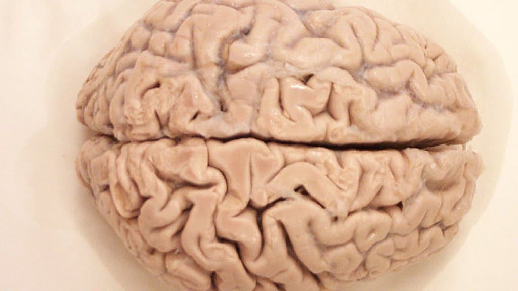 Photograph of a preserved human brain seen from above, both hemispheres visible on either side of the deep midline groove.