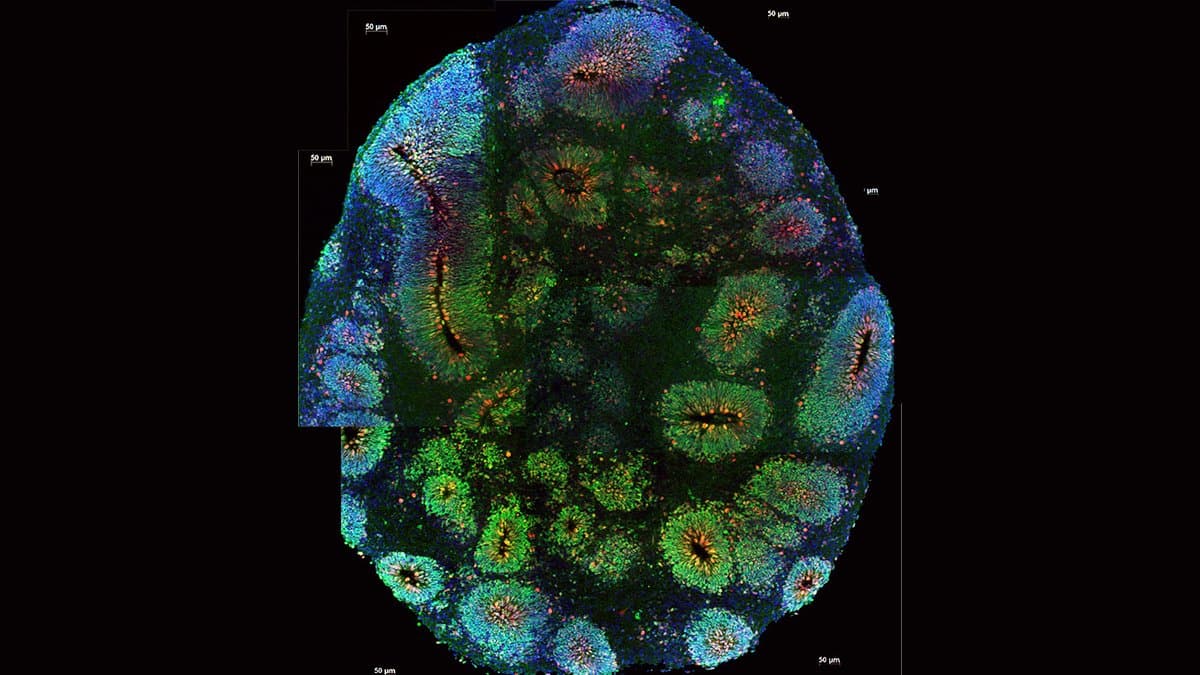 Fluorescence micrograph of a brain organoid, a ball of lab-grown neural tissue, showing rings of neural progenitor cells labeled in green, blue and red.