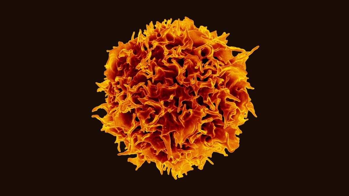 A colorized scanning electron micrograph of a single human T lymphocyte, its surface covered in fine ruffled folds, shown in orange against a black background.