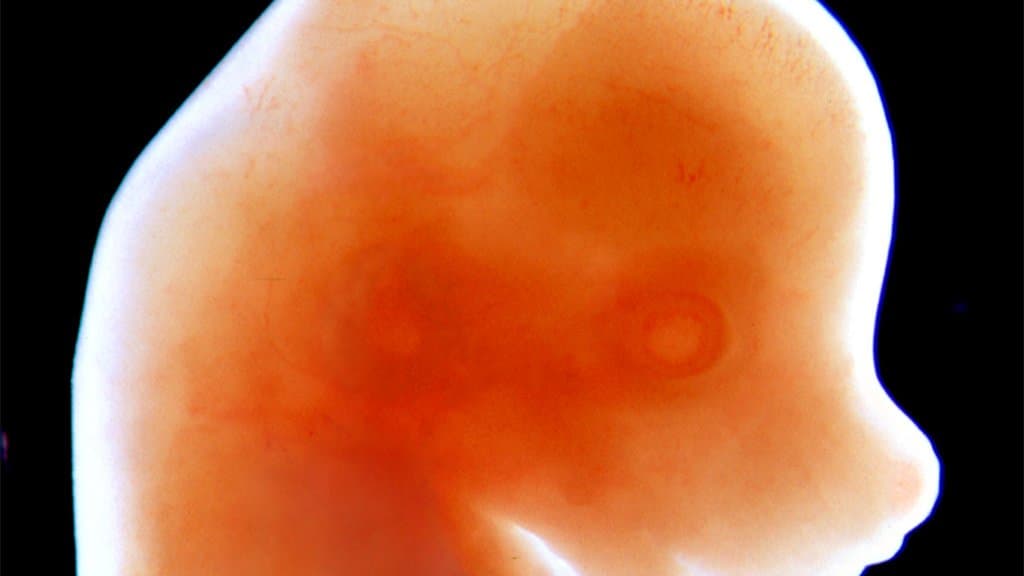 Photograph of a mouse embryo head in profile, translucent and orange against a black background.