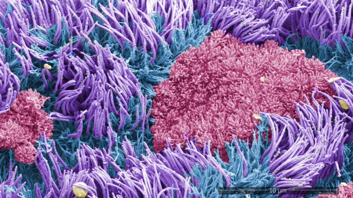 False-colored scanning electron micrograph of cultured human airway cells, with dense tufts of purple cilia covering most of the surface and round pink cell tops between them, beside a 10 micrometer scale bar.