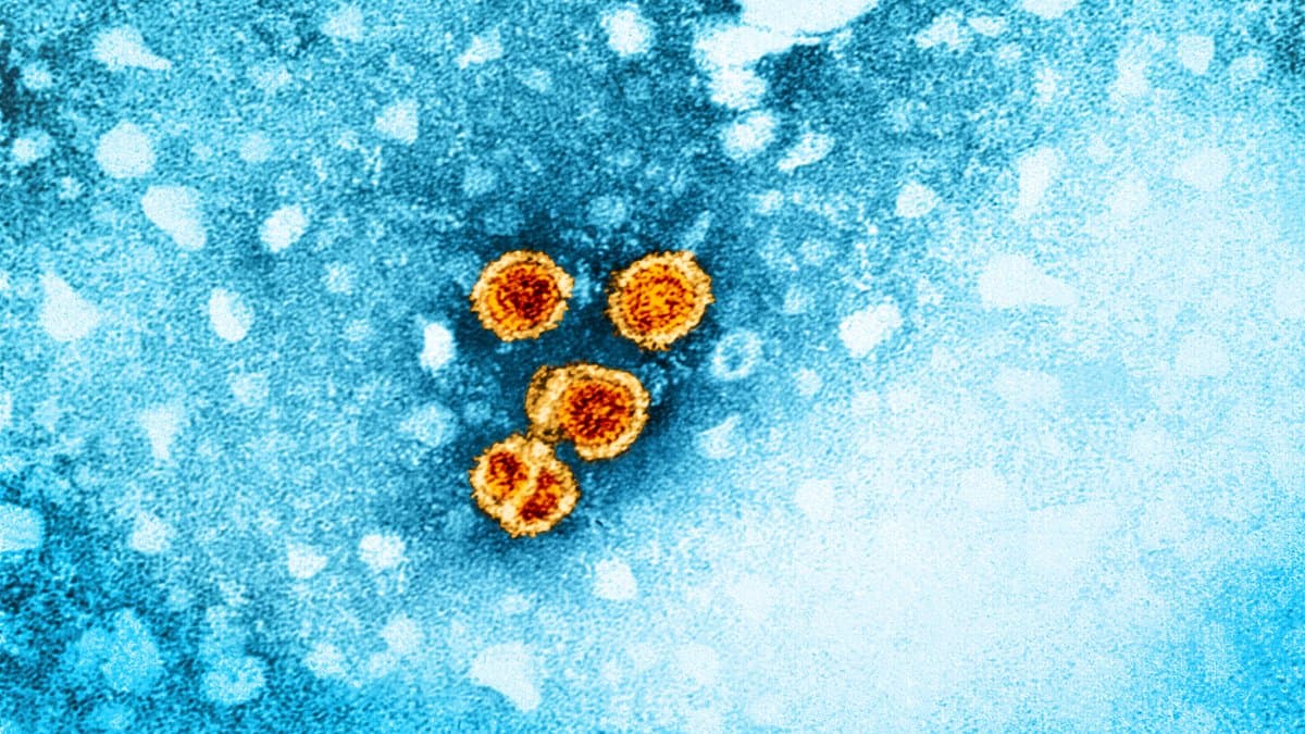 Colorized transmission electron micrograph showing four round orange hepatitis B virus particles against a blue cellular background.