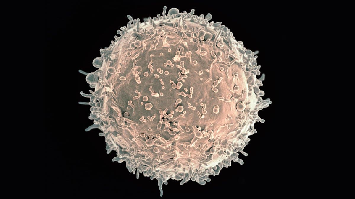 A colorized scanning electron micrograph of a single human B lymphocyte, a round immune cell covered in short surface projections, on a black background.