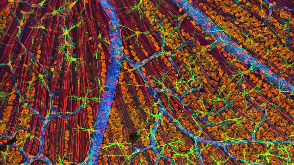 Laser scanning micrograph of a mouse retina, with green glial cells, orange retinal ganglion cell bodies, red nerve fibers and a blue branching blood vessel.