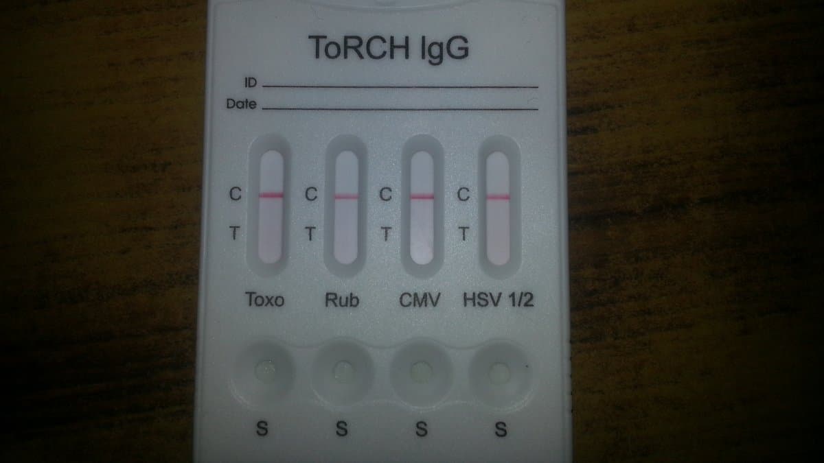 A white plastic rapid test cassette labeled ToRCH IgG, with four result windows marked Toxo, Rub, CMV and HSV 1/2.