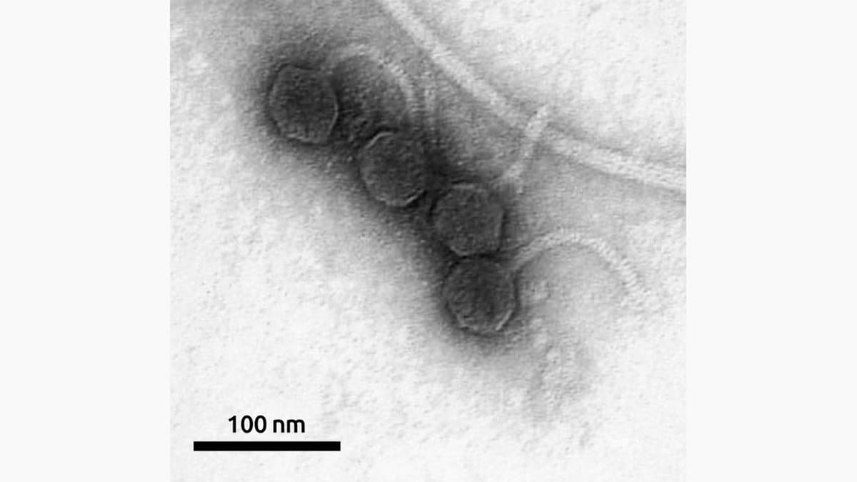 Transmission electron micrograph of four bacteriophage particles with short tails and fine fibers, beside a 100 nanometer scale bar.