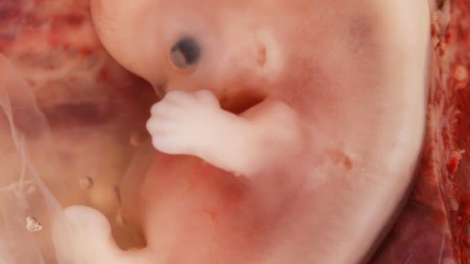 A human embryo about nine weeks after fertilization, seen within its membranes, with a dark eye, a formed nose and upper lip, and one hand raised beside the face.