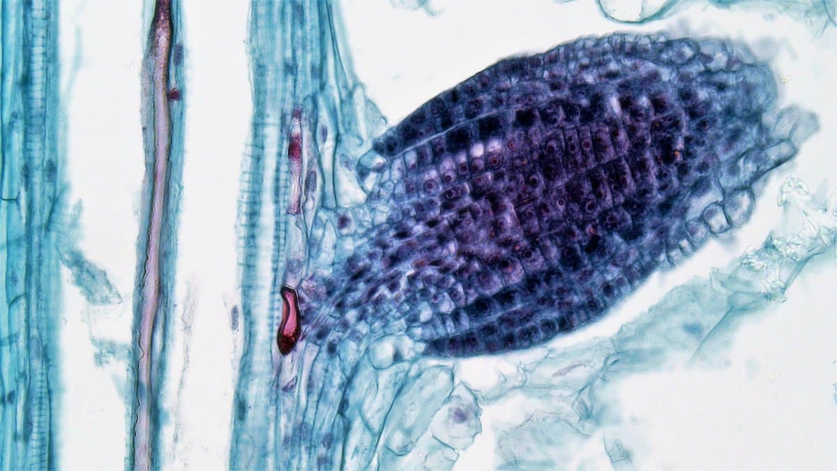 Light micrograph of a young lateral root emerging sideways through the tissue of a parent root, stained purple against pale blue cells.