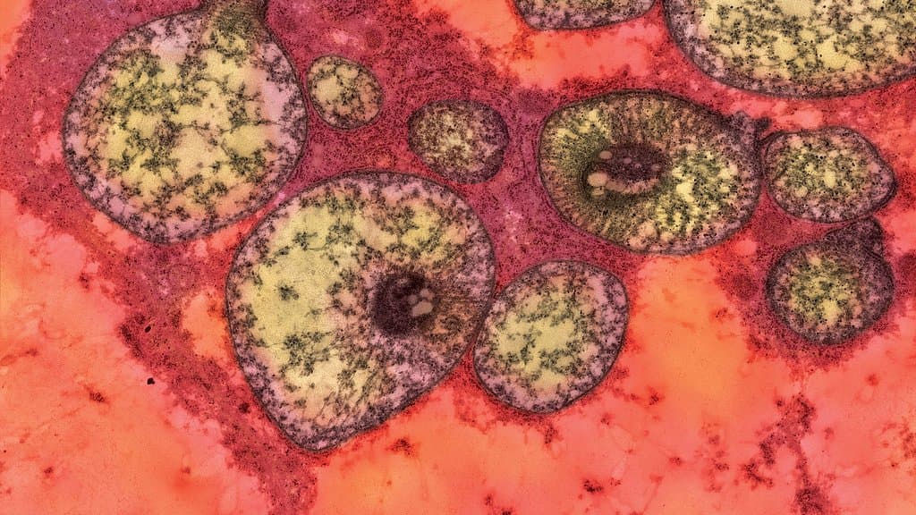 Colorized transmission electron micrograph of several swollen, pale mitochondria inside a red-stained mouse cell.
