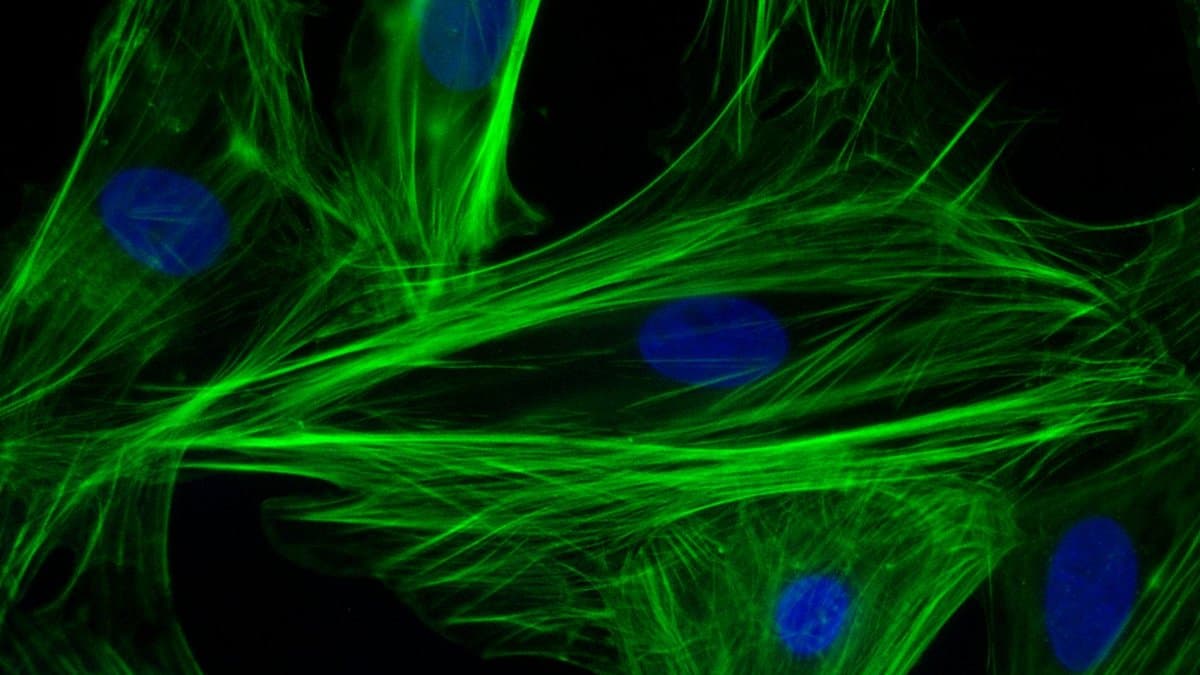 Fluorescence micrograph of heart muscle cells with actin filaments stained green and cell nuclei stained blue.
