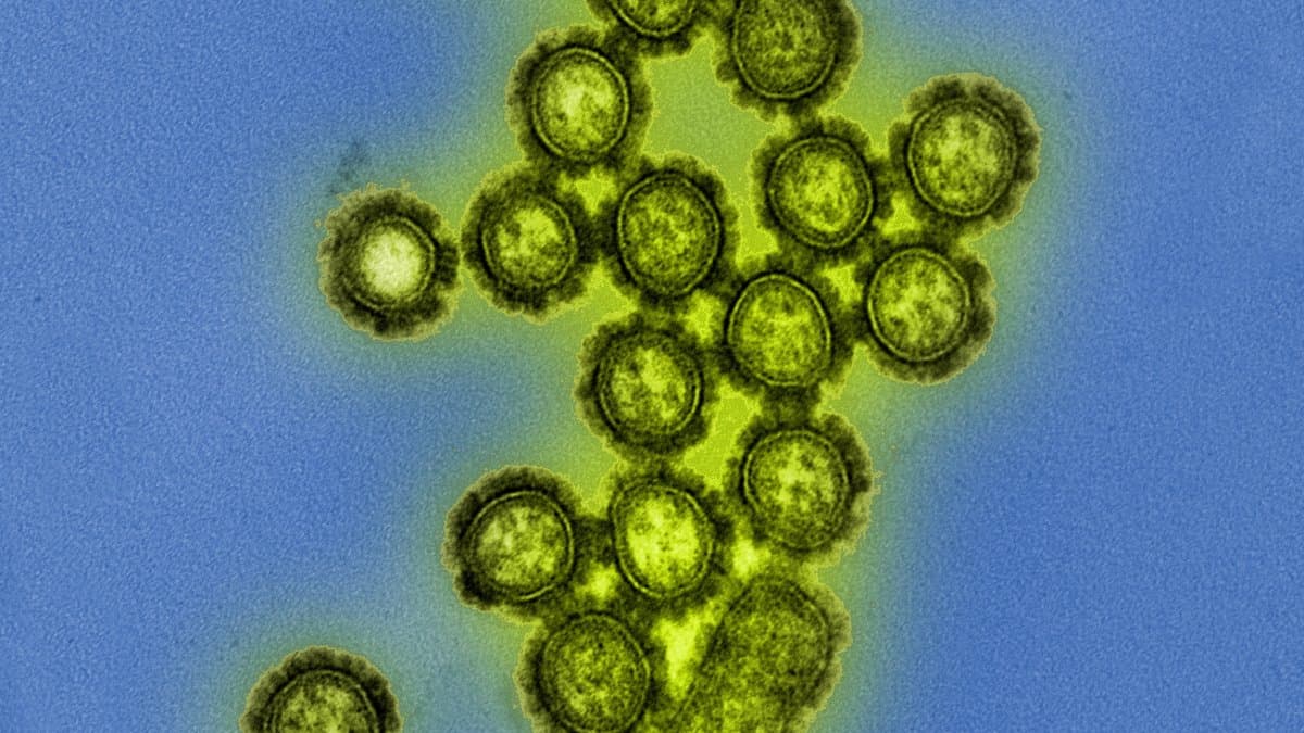 Colorized electron micrograph of a cluster of rounded influenza A virus particles, each ringed by a dense fringe of surface spikes, on a blue background.