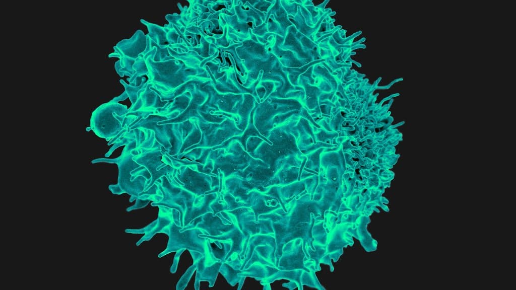 Colorized scanning electron micrograph of a single human T lymphocyte, a rounded cell covered in fine surface projections, on a black background.