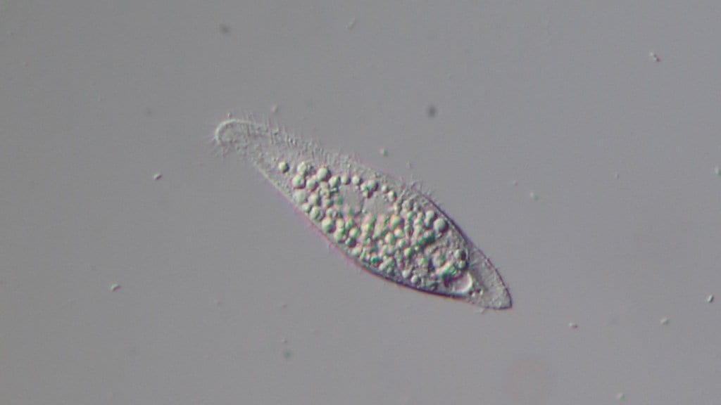 Light-microscope image of a single-celled ciliate protist magnified 160 times
