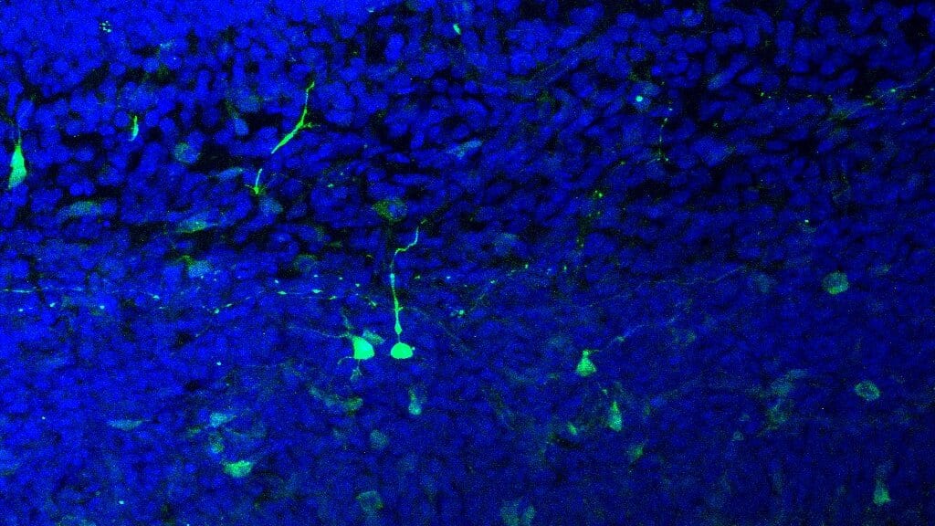 A fluorescence microscopy image of brain tissue with labelled neurons glowing green and blue.