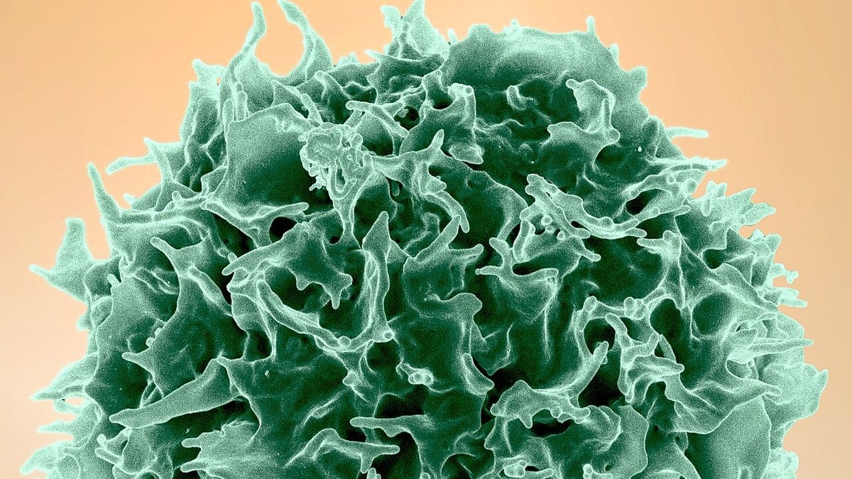 A colourised scanning electron micrograph of a single human T cell: a roughly spherical cell rendered in green, its whole surface thrown into deep folds and thin spiky projections, against a plain peach-coloured background.