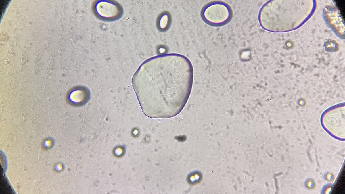 Oval starch granules seen through a microscope, showing their layered internal rings