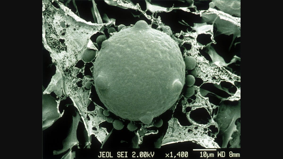 Scanning electron micrograph of chytrid fungus cells, showing rounded sporangia with slender discharge tubes on a textured surface.