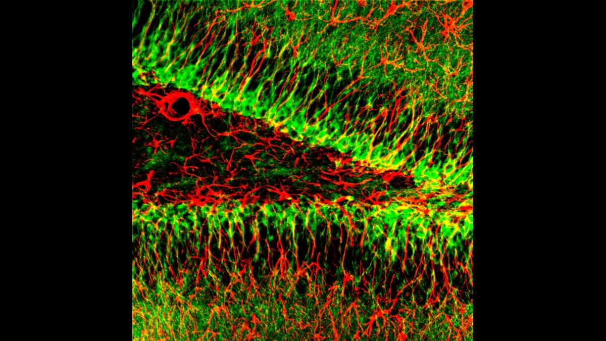 Fluorescence micrograph of the dentate gyrus with doublecortin-labelled immature neurons glowing along the granule cell layer.