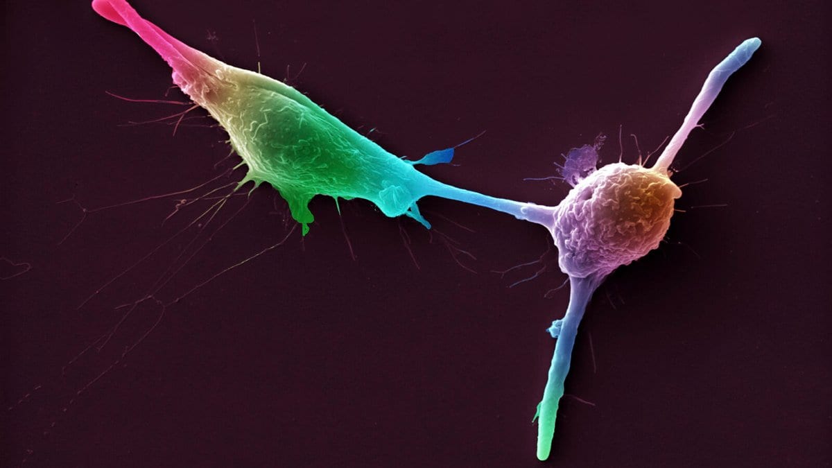 Colour-enhanced scanning electron micrograph of two cultured macrophages with ruffled surfaces and long thin projections, shown in green, pink and blue against a dark purple background.