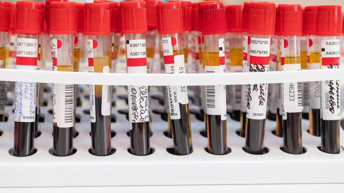 Rack of stoppered blood collection tubes with handwritten labels and barcodes, each holding straw-colored serum above dark settled blood.