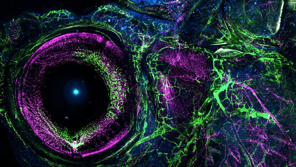 Fluorescence micrograph of a young zebrafish head, showing blood vessels and lymphatic vessels labeled in green and magenta around the eye.