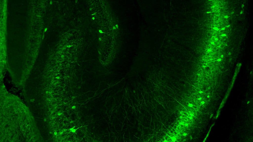 Fluorescence micrograph of brain tissue in which inhibitory interneurons appear as bright green cells and fibers against a dark background.