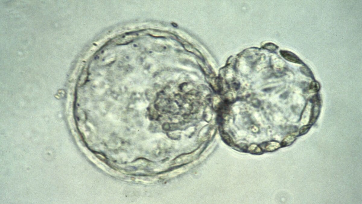 Light micrograph of a human blastocyst emerging from the zona pellucida, seen as two adjoining rounded bodies.