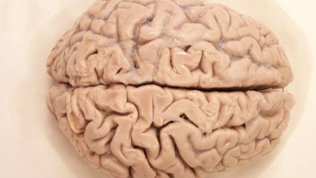 Photograph of a preserved human brain seen from above, both hemispheres visible on either side of the deep midline groove.