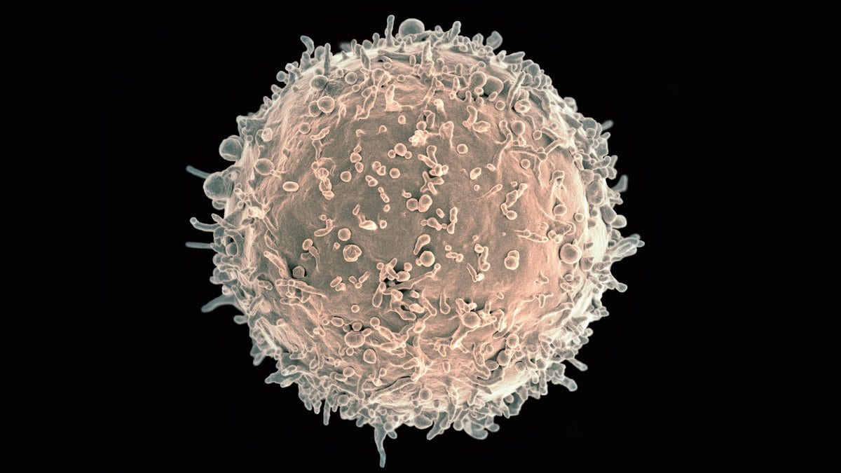 A colorized scanning electron micrograph of a single human B lymphocyte, a round immune cell covered in short surface projections, on a black background.