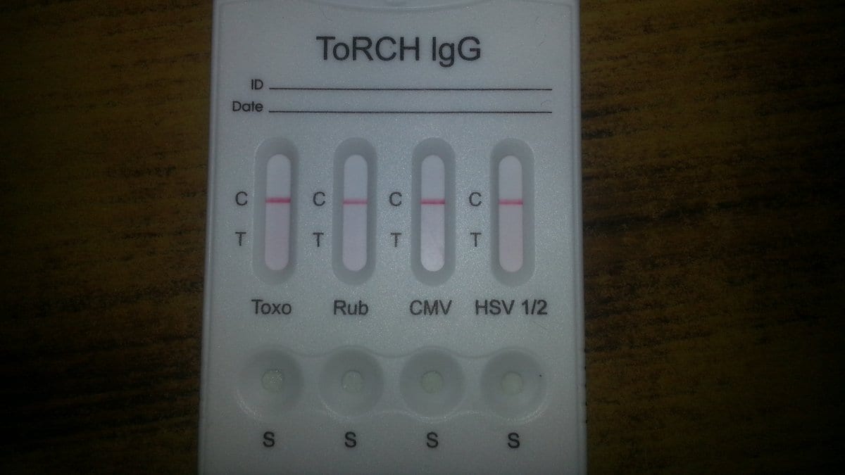 A white plastic rapid test cassette labeled ToRCH IgG, with four result windows marked Toxo, Rub, CMV and HSV 1/2.